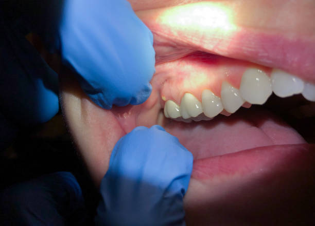 Best Emergency Treatment for Jaw Pain or Injury in Soh Weber, UT